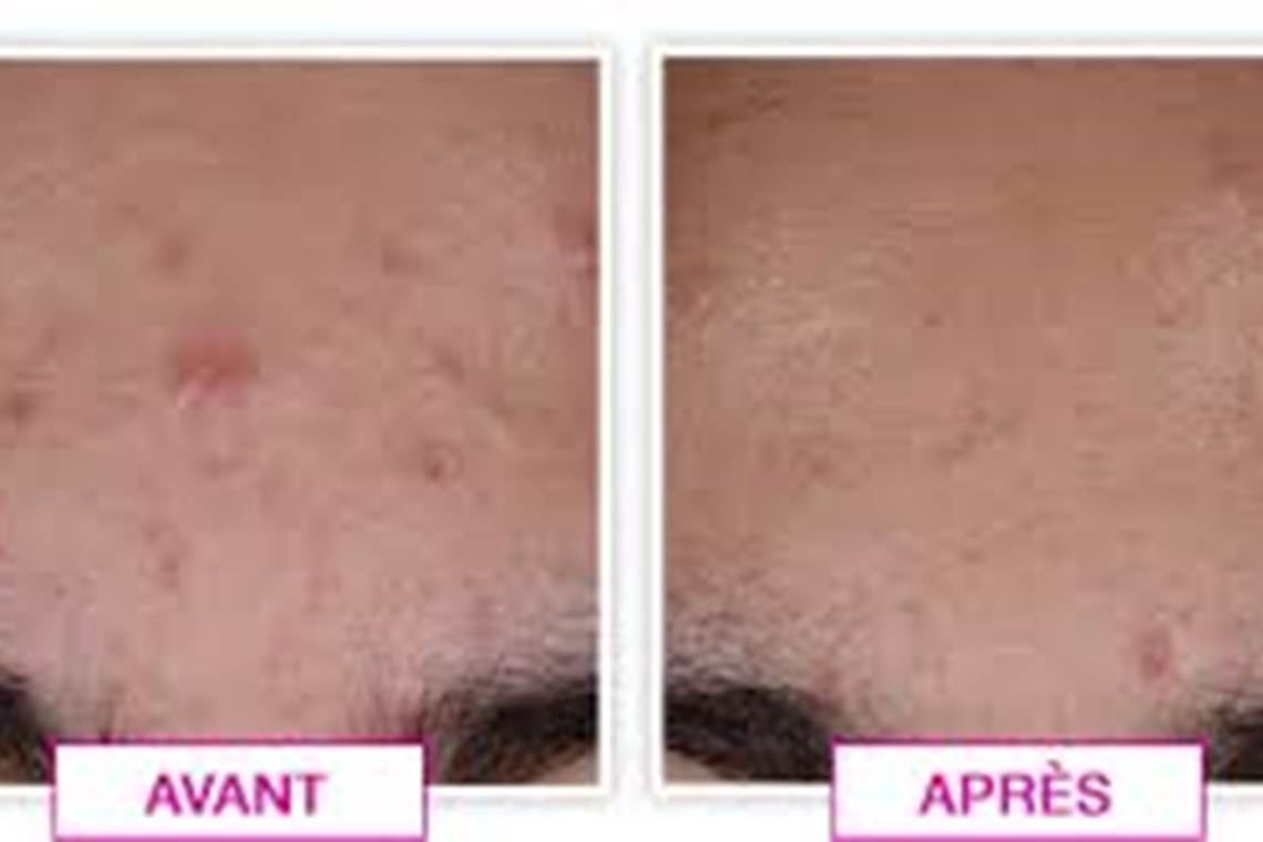 résultats deux mois d'utilisation