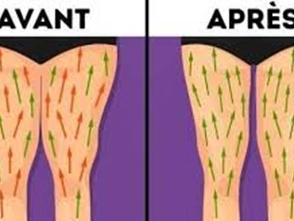Avant /Après